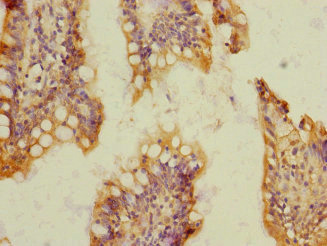 Immunohistochemistry of paraffin-embedded human small intestine tissue using CSB-PA022386ESR1HU at dilution of 1:100