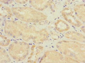 Immunohistochemistry of paraffin-embedded human kidney tissue using CSB-PA022395ESR1HU at dilution of 1:100 Immunohistochemistry of paraffin-embedded human kidney tissue using CSB-PA022395ESR1HU at dilution of 1:100
