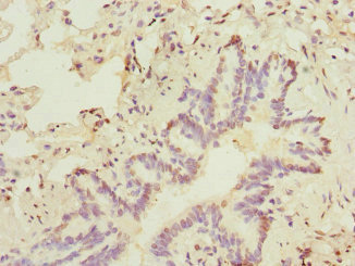 Immunohistochemistry of paraffin-embedded human lung tissue using CSB-PA022432DSR2HU at dilution of 1:100 Immunohistochemistry of paraffin-embedded human lung tissue using CSB-PA022432DSR2HU at dilution of 1:100