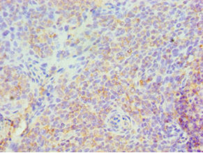 Immunohistochemistry of paraffin-embedded human tonsil tissue using CSB-PA022590ESR1HU at dilution of 1:100 Immunohistochemistry of paraffin-embedded human tonsil tissue using CSB-PA022590ESR1HU at dilution of 1:100