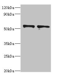 Western Blotting(WB) - SPTLC1 Antibody
