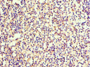 Immunohistochemistry of paraffin-embedded human spleen tissue using CSB-PA022664ESR1HU at dilution of 1:100 Immunohistochemistry of paraffin-embedded human spleen tissue using CSB-PA022664ESR1HU at dilution of 1:100