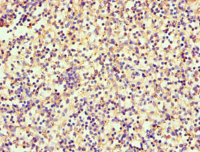 Immunohistochemistry of paraffin-embedded human spleen tissue using CSB-PA022664ESR2HU at dilution of 1:100