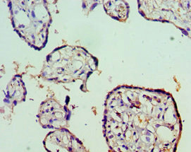 Immunohistochemistry of paraffin-embedded human placenta tissue using CSB-PA022815ESR1HU at dilution of 1:100