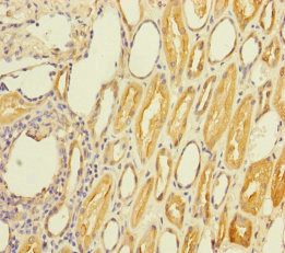 Immunohistochemistry of paraffin-embedded human kidney tissue using CSB-PA022822ESR1HU at dilution of 1:100 Immunohistochemistry of paraffin-embedded human kidney tissue using CSB-PA022822ESR1HU at dilution of 1:100