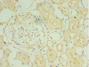 Immunohistochemistry of paraffin-embedded human kidney tissue using CSB-PA022938ESR1HU at dilution of 1:100