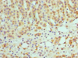 Immunohistochemistry of paraffin-embedded human adrenal gland tissue using CSB-PA022942ESR1HU at dilution of 1:100