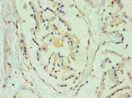 Immunohistochemistry of paraffin-embedded human prostate tissue using CSB-PA022943ESR2HU at dilution of 1:100
