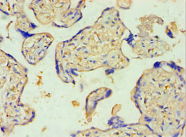 Immunohistochemistry of paraffin-embedded human placenta tissue using CSB-PA022943ESR2HU at dilution of 1:100