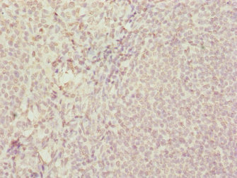 Immunohistochemistry of paraffin-embedded human tonsil tissue using CSB-PA022957ESR1HU at dilution of 1:100 Immunohistochemistry of paraffin-embedded human tonsil tissue using CSB-PA022957ESR1HU at dilution of 1:100