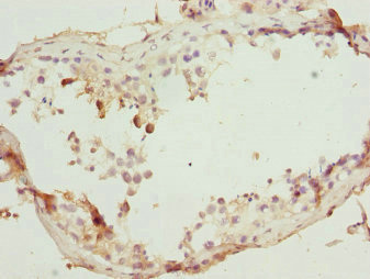 Immunohistochemistry of paraffin-embedded human testis tissue using CSB-PA022957ESR1HU at dilution of 1:100