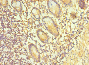 Immunohistochemistry of paraffin-embedded human small intestine tissue using CSB-PA023062ESR1HU at dilution of 1:100