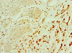 Immunohistochemistry of paraffin-embedded human epityphlon tissue using CSB-PA023062ESR1HU at dilution of 1:100