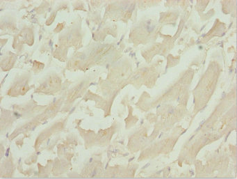Immunohistochemistry of paraffin-embedded human heart tissue using CSB-PA023240ESR1HU at dilution of 1:100