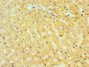 Immunohistochemistry of paraffin-embedded human liver tissue using CSB-PA023243DSR1HU at dilution of 1:100 Immunohistochemistry of paraffin-embedded human liver tissue using CSB-PA023243DSR1HU at dilution of 1:100