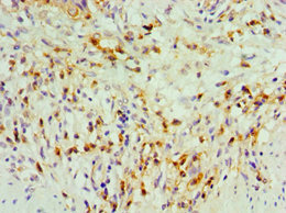 Immunohistochemistry of paraffin-embedded human gallbladder tissue using CSB-PA023343ESR1HU at dilution of 1:100 Immunohistochemistry of paraffin-embedded human gallbladder tissue using CSB-PA023343ESR1HU at dilution of 1:100
