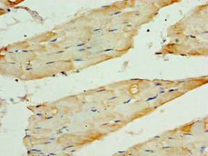 Immunohistochemistry of paraffin-embedded human skeletal muscle tissue using CSB-PA023386ESR1HU at dilution of 1:100 Immunohistochemistry of paraffin-embedded human skeletal muscle tissue using CSB-PA023386ESR1HU at dilution of 1:100