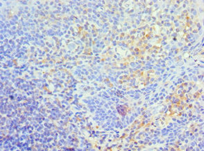 Immunohistochemistry of paraffin-embedded human tonsil tissue using CSB-PA023438DSR1HU at dilution of 1:100