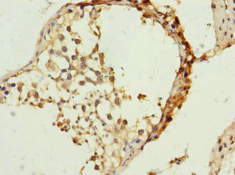 Immunohistochemistry of paraffin-embedded human testis tissue using CSB-PA023553ESR2HU at dilution of 1:100