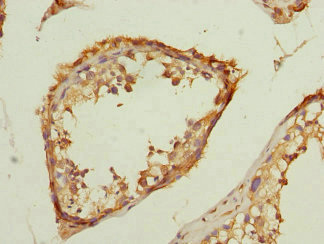 Immunohistochemistry of paraffin-embedded human testis tissue using CSB-PA023655ESR2HU at dilution of 1:100