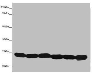 Western blot All lanes: TMED10 antibody at 4.88microg/ml Lane 1: Hela whole cell lysate Lane 2: Mouse liver tissue Lane 3: Mouse lung tissue Lane 4: 293T whole cell lysate Lane 5: NIH/3T3 whole cell lysate Lane 6: U87 whole cell lysate Secondary Goat polyclonal to rabbit IgG at 1/10000 dilution Predicted band size: 25 kDa Observed band size: 25 kDa