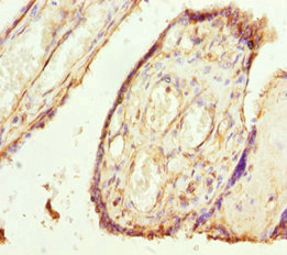 Immunohistochemistry of paraffin-embedded human placenta tissue using CSB-PA023840ESR2HU at dilution of 1:100 Immunohistochemistry of paraffin-embedded human placenta tissue using CSB-PA023840ESR2HU at dilution of 1:100