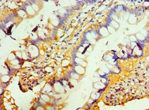 Immunohistochemistry of paraffin-embedded human small intestine tissue using CSB-PA023971DSR2HU at dilution of 1:100 Immunohistochemistry of paraffin-embedded human small intestine tissue using CSB-PA023971DSR2HU at dilution of 1:100