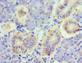 Immunohistochemistry of paraffin-embedded human pancreatic tissue using CSB-PA023989ESR1HU at dilution of 1:100