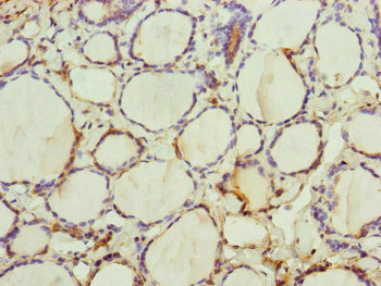 Immunohistochemistry of paraffin-embedded human thyroid tissue using CSB-PA024459ESR1HU at dilution of 1:100
