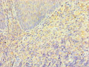 Immunohistochemistry of paraffin-embedded human tonsil tissue using CSB-PA025084ESR2HU at dilution of 1:100