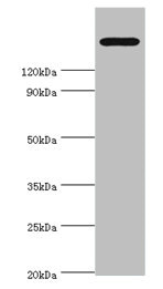Western blot All lanes: TRPM2 antibody at 2microg/ml + K562 whole cell lysate Secondary Goat polyclonal to rabbit IgG at 1/10000 dilution Predicted band size: 172, 166, 96 kDa Observed band size: 172 kDa Western blot All lanes: TRPM2 antibody at 2microg/ml + K562 whole cell lysate Secondary Goat polyclonal to rabbit IgG at 1/10000 dilution Predicted band size: 172, 166, 96 kDa Observed band size: 172 kDa