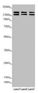 Western blot All lanes: UACA antibody at 5.51microg/ml Lane 1: Hela whole cell lysate Lane 2: A549 whole cell lysate Lane 3: Jurkat whole cell lysate Secondary Goat polyclonal to rabbit IgG at 1/10000 dilution Predicted band size: 163, 162 kDa Observed band size: 163, 140 kDa Western blot All lanes: UACA antibody at 5.51microg/ml Lane 1: Hela whole cell lysate Lane 2: A549 whole cell lysate Lane 3: Jurkat whole cell lysate Secondary Goat polyclonal to rabbit IgG at 1/10000 dilution Predicted band size: 163, 162 kDa Observed band size: 163, 140 kDa