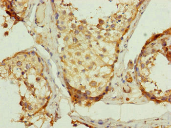 Immunohistochemistry of paraffin-embedded human testis tissue using CSB-PA025668ESR1HU at dilution of 1:100