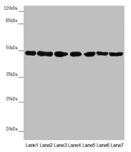 Western blot All lanes: UQCRC2 antibody at 2.95microg/ml Lane 1: Human placenta tissue Lane 2: Mouse large intestine tissue Lane 3: Mouse small intestine tissue Lane 4: Mouse brain tissue Lane 5: HepG2 whole cell lysate Lane 6: Jurkat whole cell lysate Lane 7: 293T whole cell lysate Secondary Goat polyclonal to rabbit IgG at 1/10000 dilution Predicted band size: 48 kDa Observed band size: 48 kDa Western blot All lanes: UQCRC2 antibody at 2.95microg/ml Lane 1: Human placenta tissue Lane 2: Mouse large intestine tissue Lane 3: Mouse small intestine tissue Lane 4: Mouse brain tissue Lane 5: HepG2 whole cell lysate Lane 6: Jurkat whole cell lysate Lane 7: 293T whole cell lysate Secondary Goat polyclonal to rabbit IgG at 1/10000 dilution Predicted band size: 48 kDa Observed band size: 48 kDa