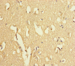 Immunohistochemistry of paraffin-embedded human brain tissue using CSB-PA025710ESR1HU at dilution of 1:100