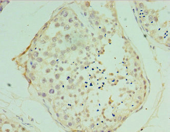 Immunohistochemistry of paraffin-embedded human testis tissue using CSB-PA025781ESR2HU at dilution of 1:100 Immunohistochemistry of paraffin-embedded human testis tissue using CSB-PA025781ESR2HU at dilution of 1:100