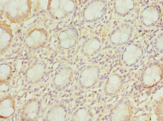 Immunohistochemistry of paraffin-embedded human colon tissue using CSB-PA025933DSR2HU at dilution of 1:100
