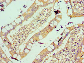 Immunohistochemistry of paraffin-embedded human small intestine tissue using CSB-PA025944ESR1HU at dilution of 1:100