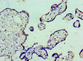 Immunohistochemistry of paraffin-embedded human placenta tissue using CSB-PA025944ESR1HU at dilution of 1:100