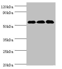 Western blot All lanes: XIAP antibody at 3microg/ml Lane 1: HepG2 whole cell lysate Lane 2: MCF-7 whole cell lysate Lane 3: PC-3 whole cell lysate Secondary Goat polyclonal to rabbit IgG at 1/10000 dilution Predicted band size: 57 kDa Observed band size: 57 kDa Western blot All lanes: XIAP antibody at 3microg/ml Lane 1: HepG2 whole cell lysate Lane 2: MCF-7 whole cell lysate Lane 3: PC-3 whole cell lysate Secondary Goat polyclonal to rabbit IgG at 1/10000 dilution Predicted band size: 57 kDa Observed band size: 57 kDa