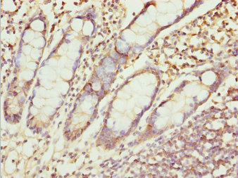 Immunohistochemistry of paraffin-embedded human small intestine tissue using CSB-PA026553ESR2HU at dilution of 1:100