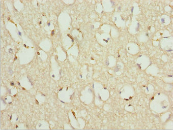 Immunohistochemistry of paraffin-embedded human brain tissue using CSB-PA026570ESR1HU at dilution of 1:100 Immunohistochemistry of paraffin-embedded human brain tissue using CSB-PA026570ESR1HU at dilution of 1:100