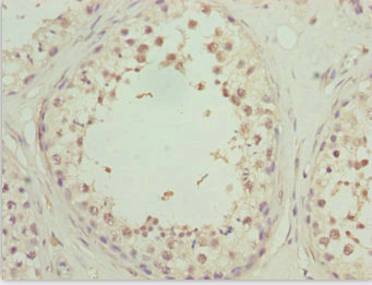Immunohistochemistry of paraffin-embedded human testis tissue using CSB-PA026573ESR1HU at dilution of 1:100