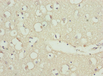 Immunohistochemistry of paraffin-embedded human brain tissue using CSB-PA026622ESR1HU at dilution of 1:100
