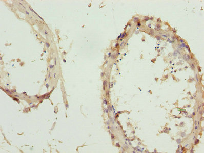 Immunohistochemistry of paraffin-embedded human testis tissue using CSB-PA026622ESR1HU at dilution of 1:100