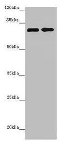 Western blot All lanes: ZNF264 antibody at 2.07microg/ml Lane 1: Jurkat whole cell lysate Lane 2: 293T whole cell lysate Secondary Goat polyclonal to rabbit IgG at 1/10000 dilution Predicted band size: 71 kDa Observed band size: 71 kDa Western blot All lanes: ZNF264 antibody at 2.07microg/ml Lane 1: Jurkat whole cell lysate Lane 2: 293T whole cell lysate Secondary Goat polyclonal to rabbit IgG at 1/10000 dilution Predicted band size: 71 kDa Observed band size: 71 kDa