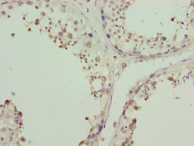Immunohistochemistry of paraffin-embedded human testis tissue using CSB-PA026622ESR2HU at dilution of 1:100