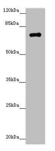 Western blot All lanes: ZNF264 antibody at 1.02microg/ml + Jurkat whole cell lysate Secondary Goat polyclonal to rabbit IgG at 1/10000 dilution Predicted band size: 71 kDa Observed band size: 71 kDa Western blot All lanes: ZNF264 antibody at 1.02microg/ml + Jurkat whole cell lysate Secondary Goat polyclonal to rabbit IgG at 1/10000 dilution Predicted band size: 71 kDa Observed band size: 71 kDa