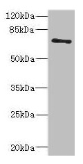 Western blot All lanes: ZNF549 antibody at 1.09microg/ml + A549 whole cell lysate Secondary Goat polyclonal to rabbit IgG at 1/10000 dilution Predicted band size: 75, 73 kDa Observed band size: 75 kDa Western blot All lanes: ZNF549 antibody at 1.09microg/ml + A549 whole cell lysate Secondary Goat polyclonal to rabbit IgG at 1/10000 dilution Predicted band size: 75, 73 kDa Observed band size: 75 kDa