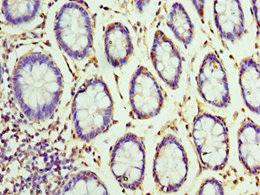 Immunohistochemistry of paraffin-embedded human colon tissue using CSB-PA528513DSR2HU at dilution of 1:100